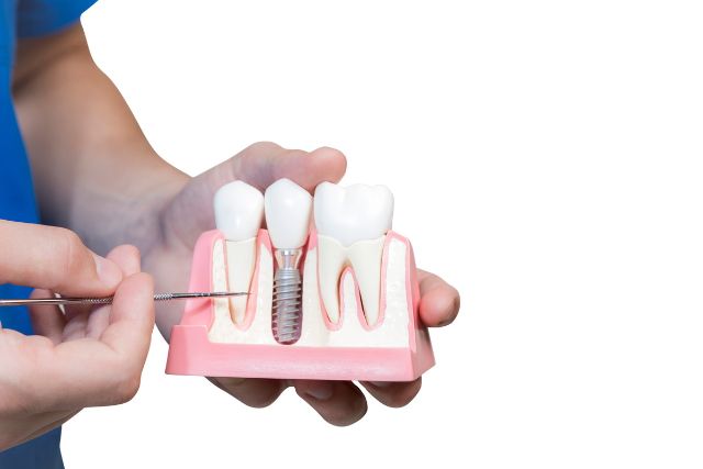 歯茎の模型