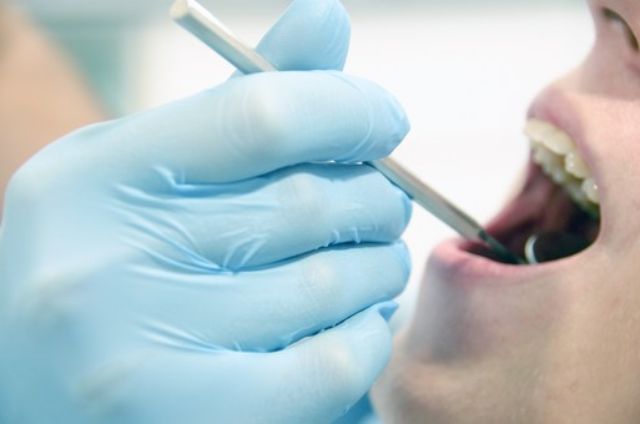 患者の歯の状態を確認する歯科医師